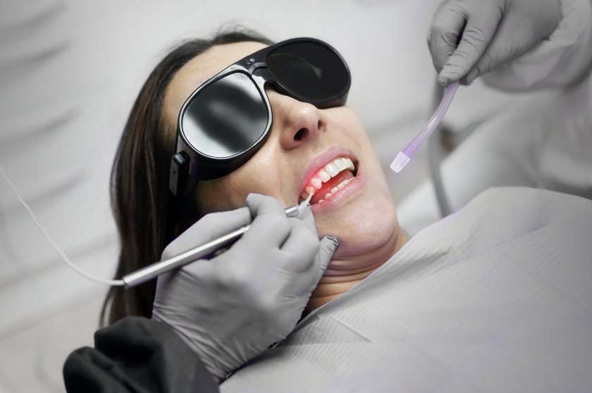 Dental laser treatment