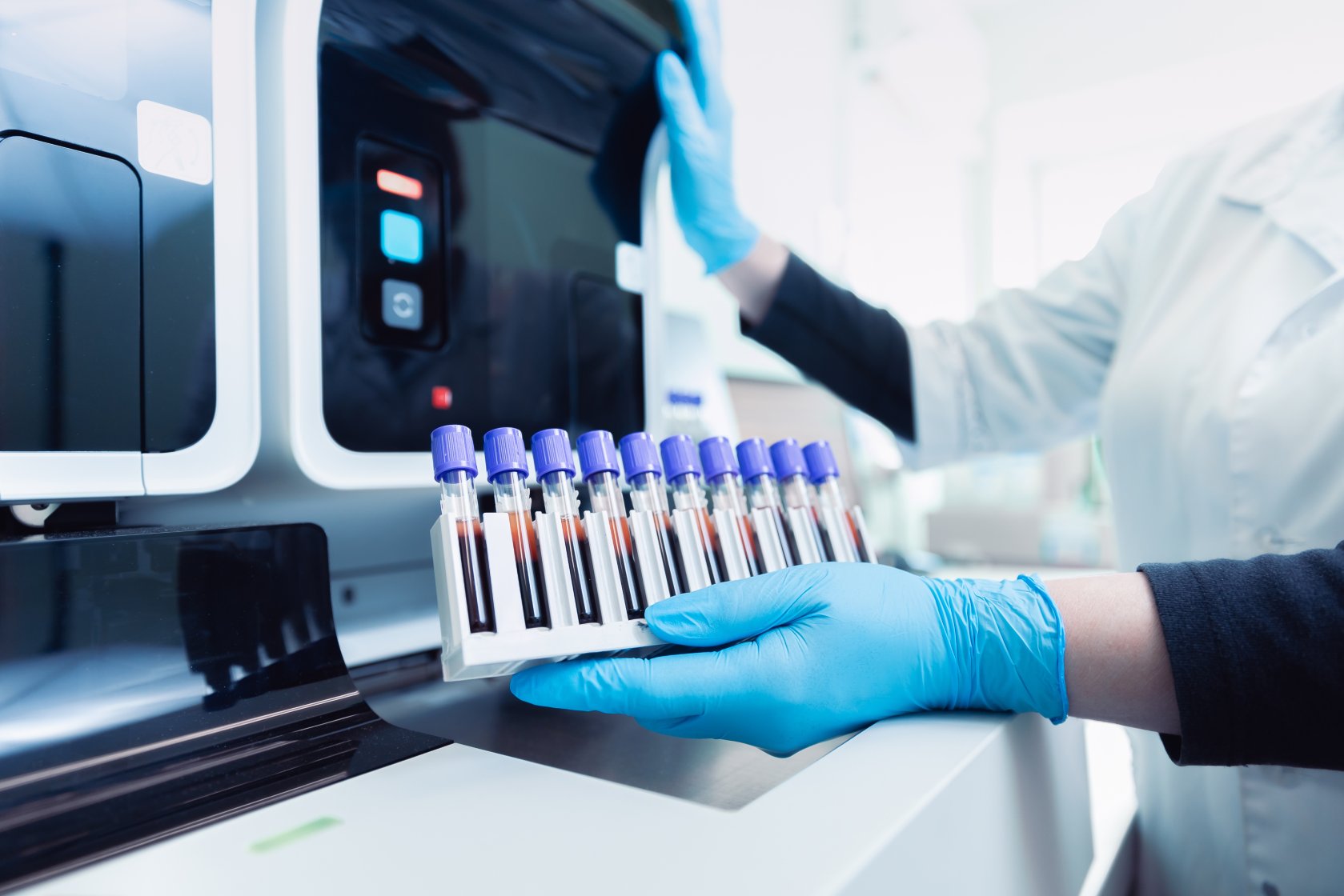 Clinician in laboratory loading a rack of test tubes into an IVD machine.